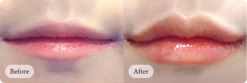 자연스럽게 아름다워지는 리핏의원