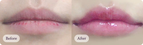 자연스럽게 아름다워지는 리핏의원