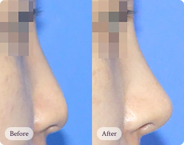 자연스럽게 아름다워지는 리핏의원