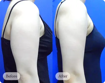 자연스럽게 아름다워지는 리핏의원